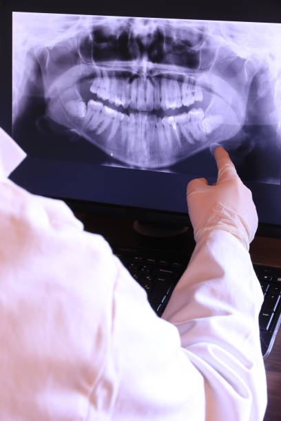 Best Emergency Tooth Extraction in Tainter Lake, WI