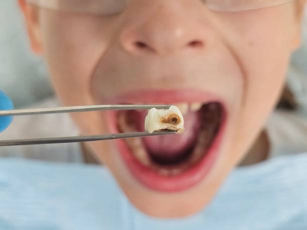 Best Emergency Dental Surgery in Tainter Lake, WI